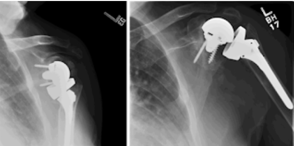 Rick Matsen tweet media