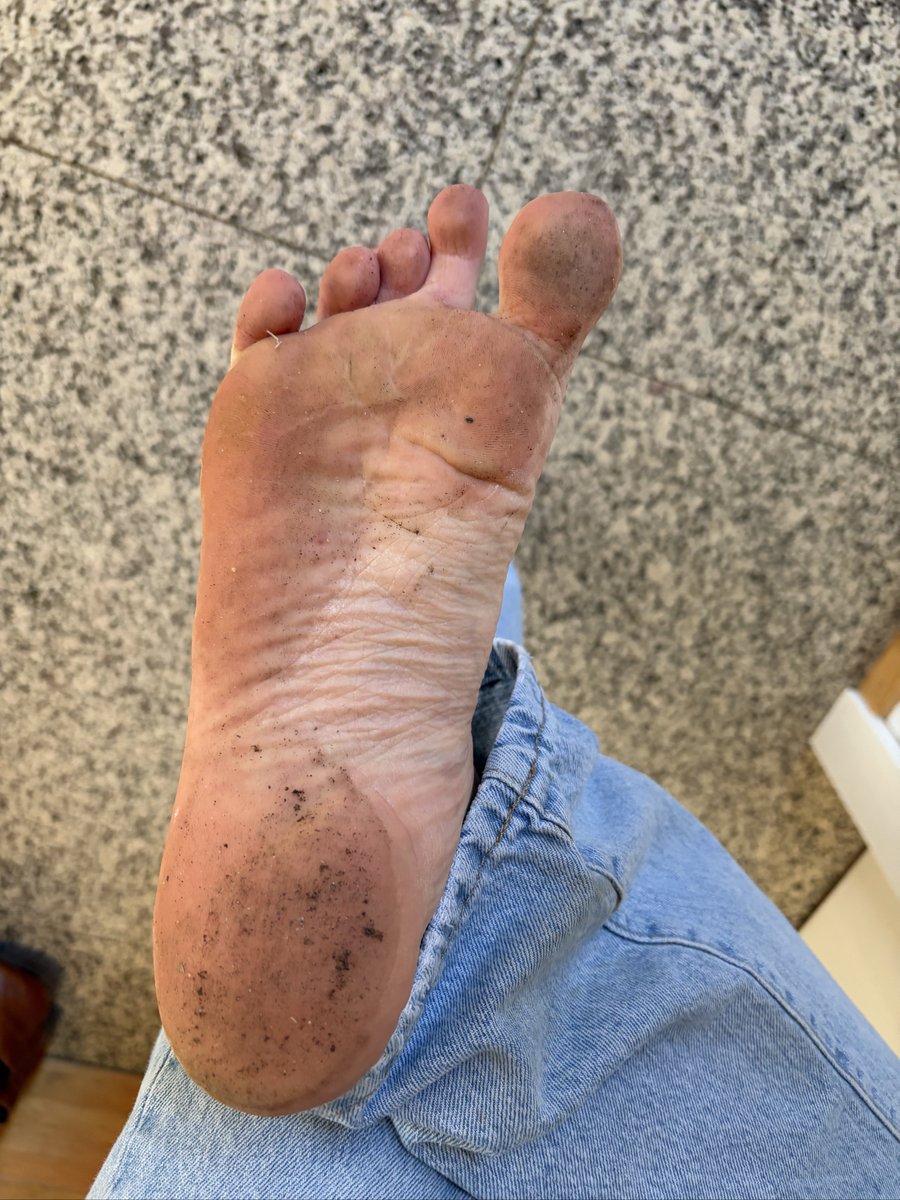 BiBoyJ2004's tweet photo. My 21yo boyfeet are pretty clean considering I walked outside barefoot but some sun could clean them more
#barefoot #footdom #bi #dirtyfeet https://t.co/VF7nVFOKWA