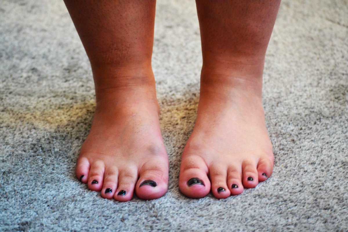 BayAreaPeds's tweet photo. Janie Lane Size 9
https://t.co/EtBM6uAPCE
#footfetısh #bayarea #soles #bigfeet #sexyfeet https://t.co/usUomidmaf