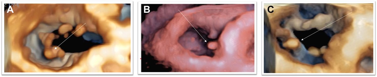 Heart Rhythm O2 tweet media