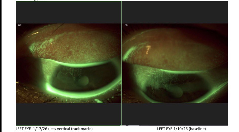 Emma🇺🇸5y👦＆35w🦕 tweet media