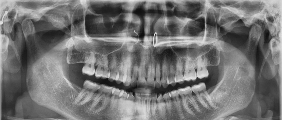 alinão 🧙🏻‍♀️🍴 tweet media