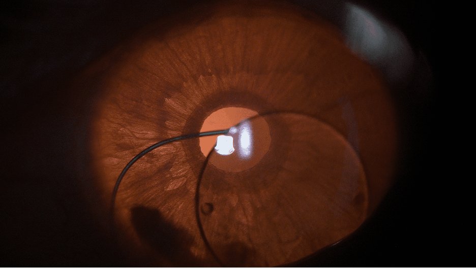 Ophthalmology 360 tweet media