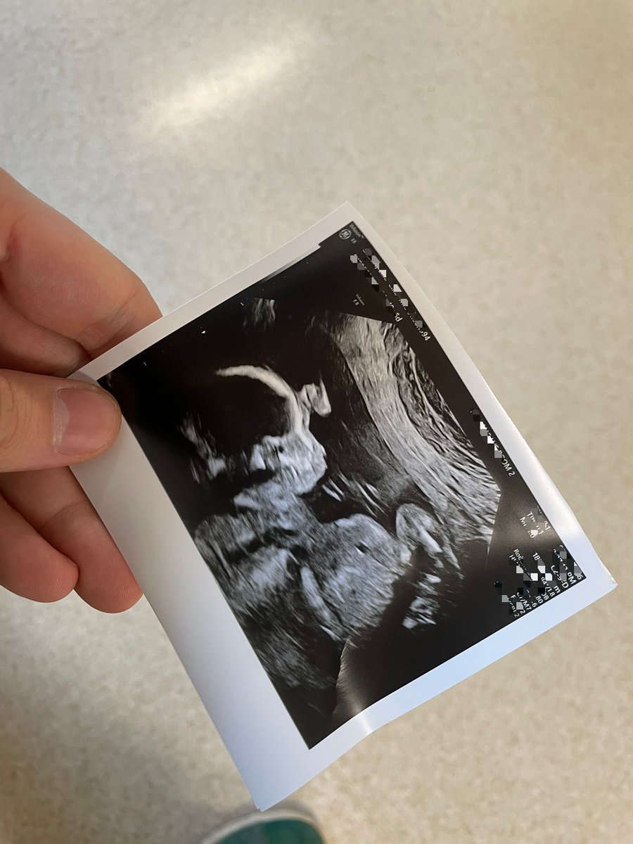 Lodz 🎩 tweet media