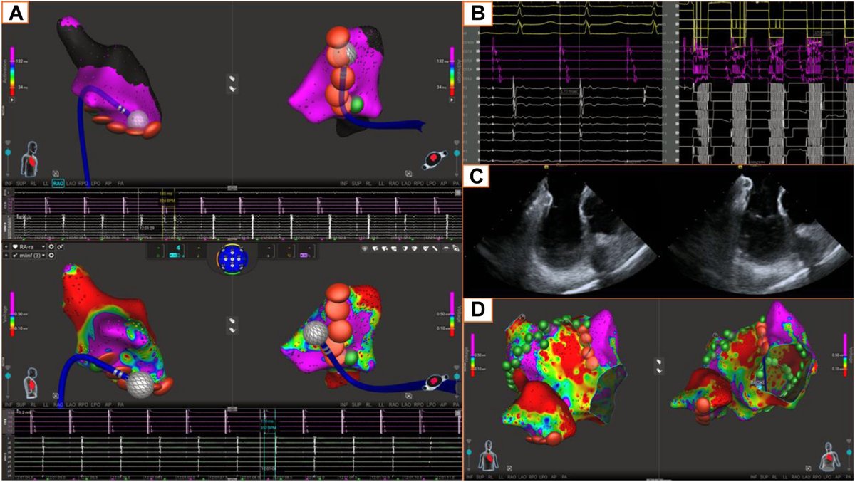 Heart Rhythm O2 tweet media