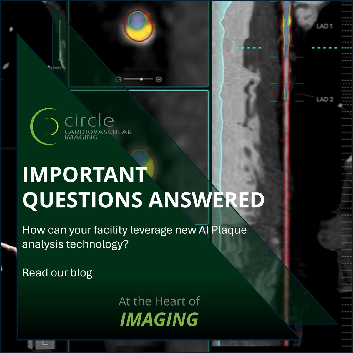 Circle Cardiovascular Imaging tweet media
