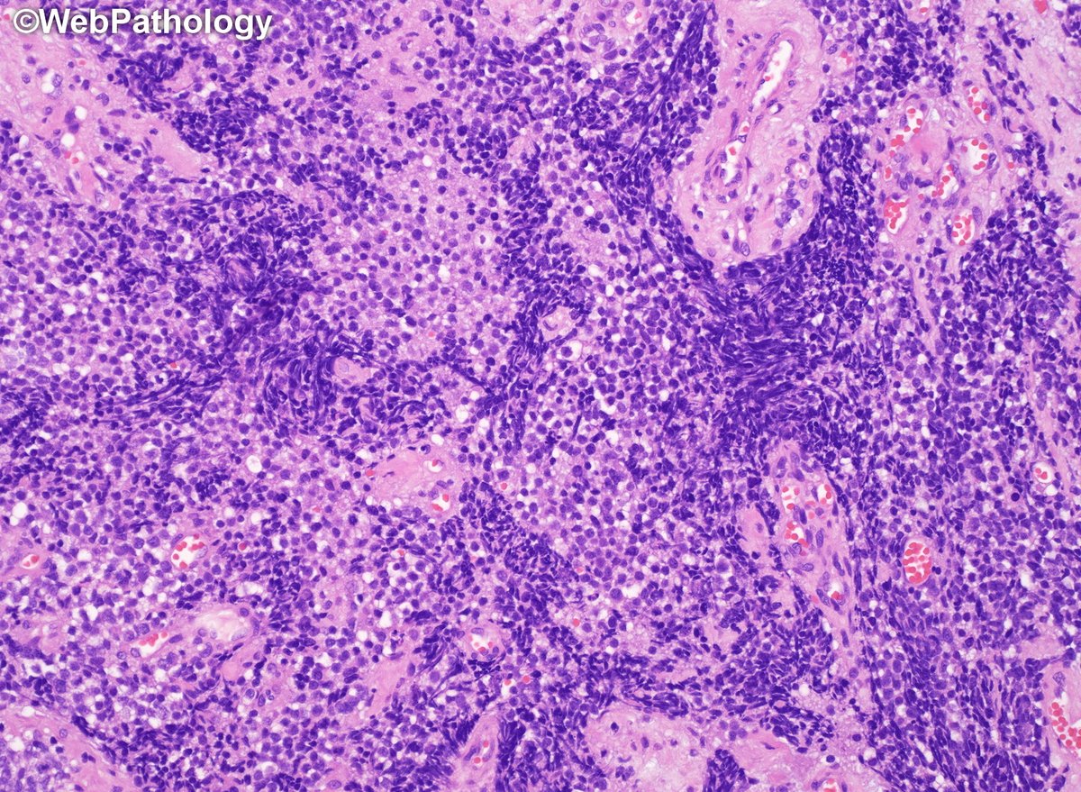 WebPathology tweet media