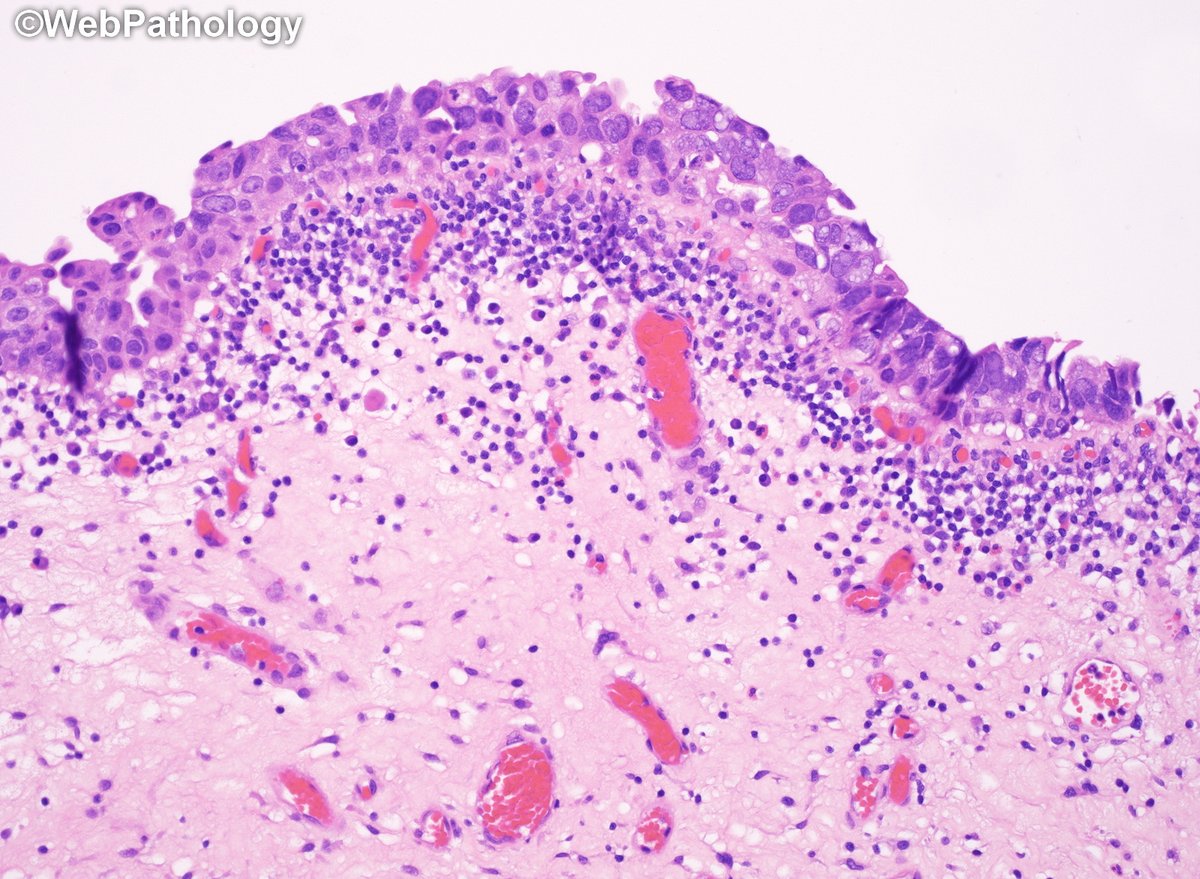 WebPathology tweet media