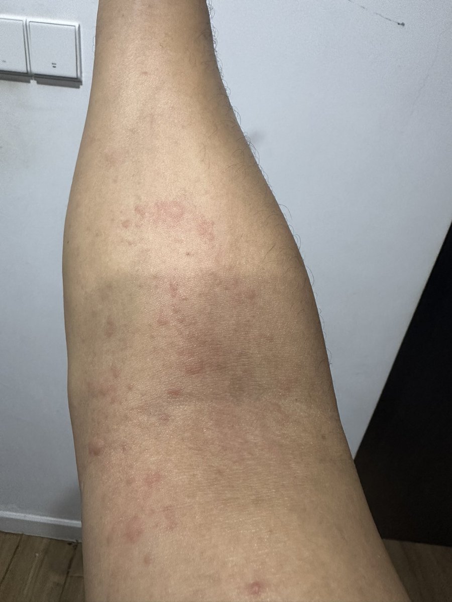 Randy Ady tweet media