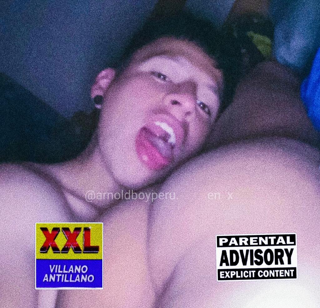 🍁𝘼𝙍𝙉𝙊𝙇𝘿 ᵛⁱⁿᵏᵉ🍌 tweet media