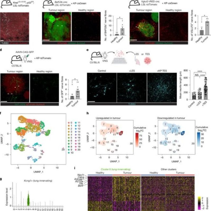 PatrickHwuMD's tweet photo. Science Saturday! Can your own brain and nervous system promote cancer growth?
 
A new study in Nature reveals a hidden “conversation” between lung tumors and the brain that shuts down the immune system.