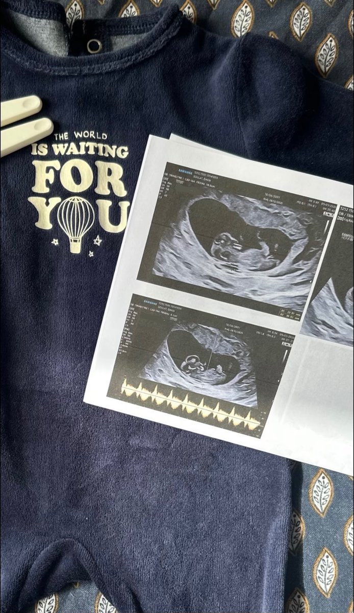 ✞𝐸𝑚𝑖 tweet media