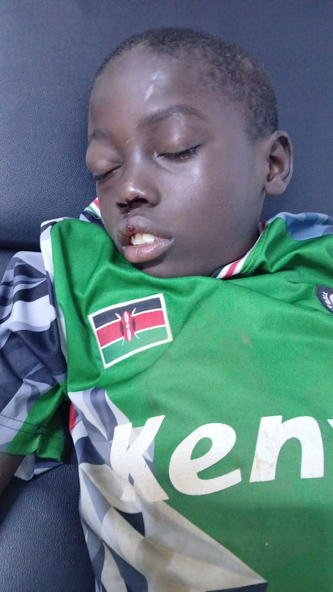 Urgent...
Child involved in accident .In critical condition .Along sunton chieko road.IF you know him or his parents kindly reach to us ...0729481298.Pinnacle medical clinic
The child tried to identify himself as LEWIS OWINO and mother MOREEN OWINO