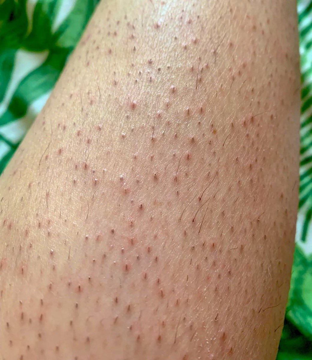 رغـد tweet media