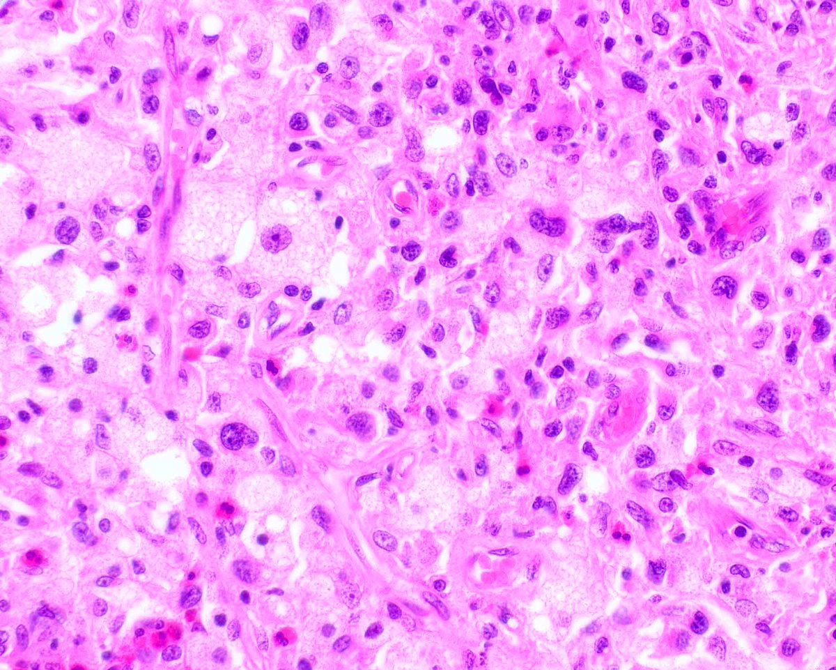 Modern Pathology tweet media