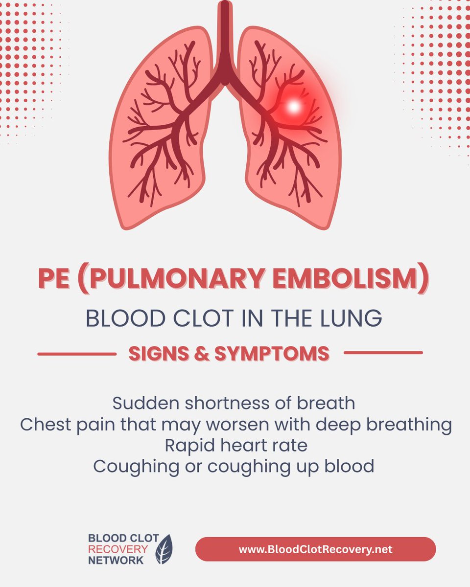 Know the signs of a pulmonary embolism (PE). A PE happens when a blood clot travels to the lungs. It is a medical emergency and requires immediate attention. If you experience these symptoms, seek medical care right away. Share the signs! #AwarenessMatters #BCAM26 #BCAM