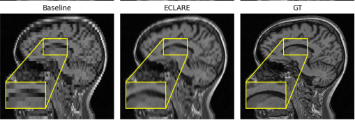kurtschilling5's tweet photo. New paper from collaborator (and past lab-mate) @sam_remedios #SPIE_JMI Introducing ECLARE: a self-supervised anisotropic resolution enhancement. I've used in with beautiful results on all sorts of contrasts brain/non-brain! https://t.co/uXkwJYIGTB https://t.co/WJh1lBNyF0