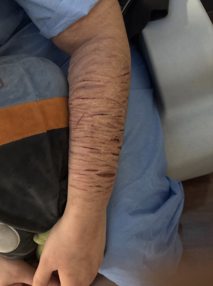 ash ★ 30 day residential brb! tweet media