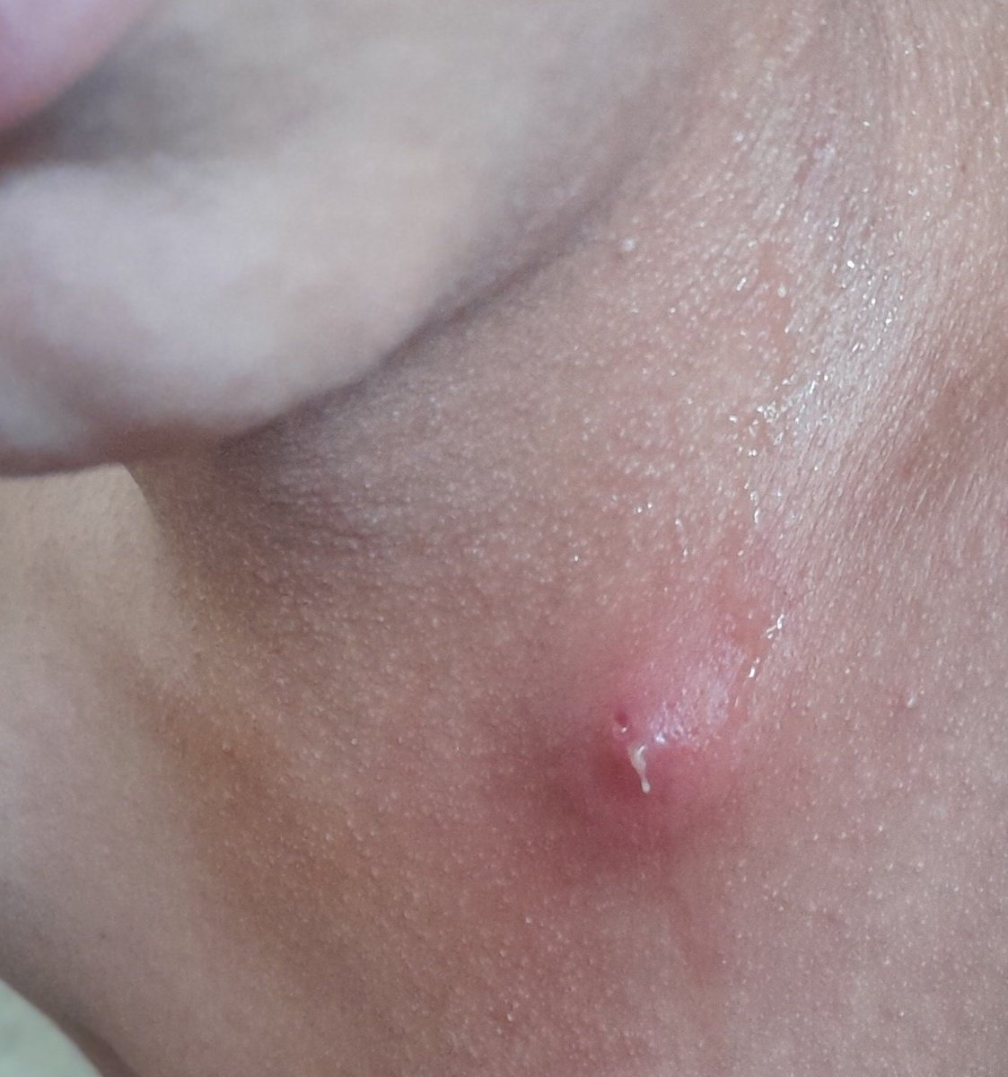 RozeatG's tweet photo. I WILL DIE😭 

Unfortunately, my poor little my daughter  body is full of pimples and I can't do anything for her. She urgently needs your help to provide tr

3 replies — even dots — can break the
 algorithm😭

https://t.co/PoTNVpFiJv https://t.co/fvCWSkC8mP