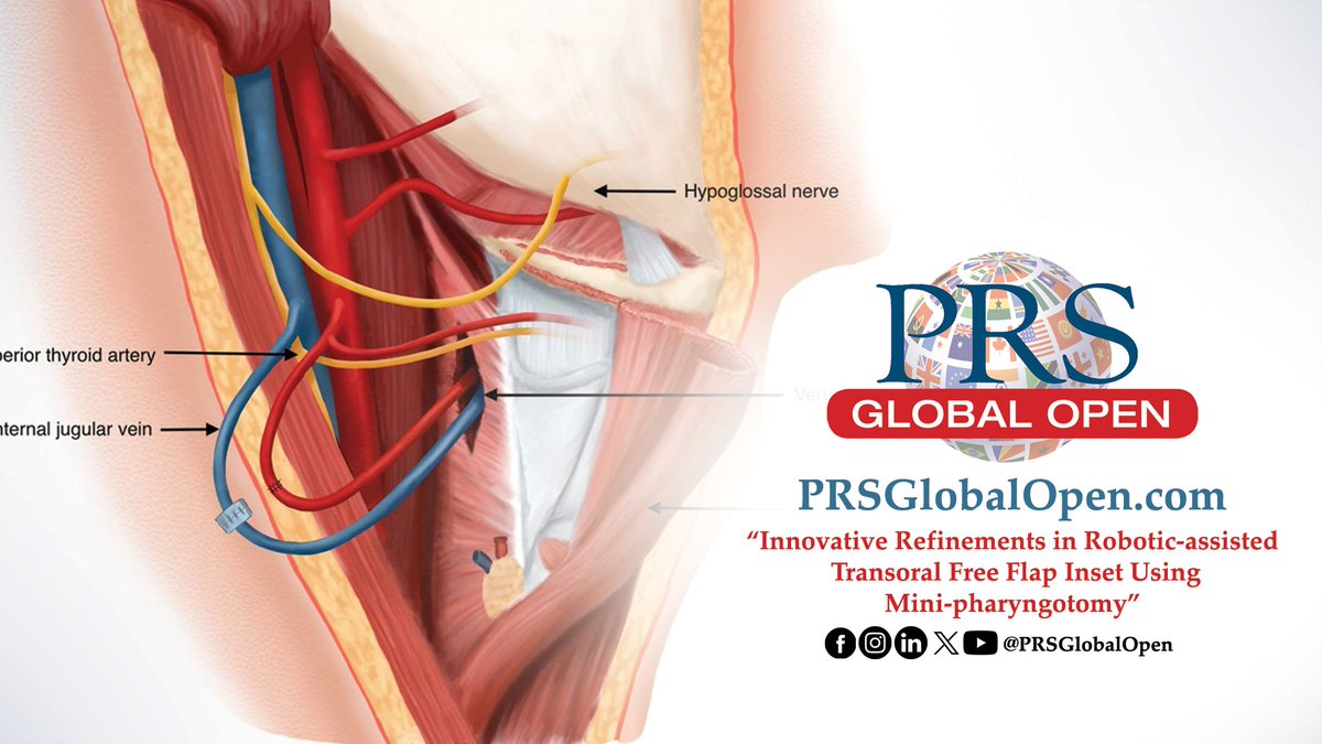 PRS Global Open tweet media