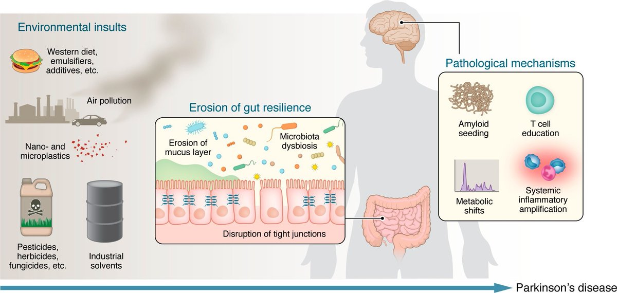 NewsMedical's tweet image. Could Parkinson’s disease actually start in the gut, not the brain?  New research highlights gut health, environment, and the microbiome as surprising influencers in PD risk.  🦠🧠 news-medical.net/news/20260305/… #Parkinsons #GutHealth @jclinicalinvest