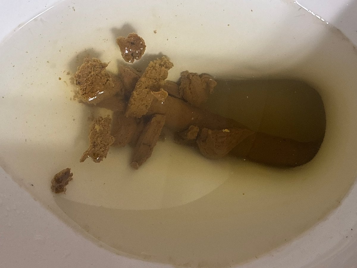 prettypoops's tweet photo. It felt sooo good to get this out😩. Wanna see the video?🙈

#scat #scatgirl #scatporn #scatfetish
#poopfetish #girlpoop
#womenpooping #girlshitting #nastyporn
#toilet #womenshitting
#pooping #poop #fart #fartfetish https://t.co/9Mbn49JWPS