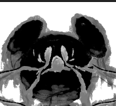 "They say the mouse lost more than his mind that night… he lost her"

Credits:
<a href="/huawei4777432/">JsBogdan</a> 
#FNF #fnfmod #MickeyMouseINSomberTunes