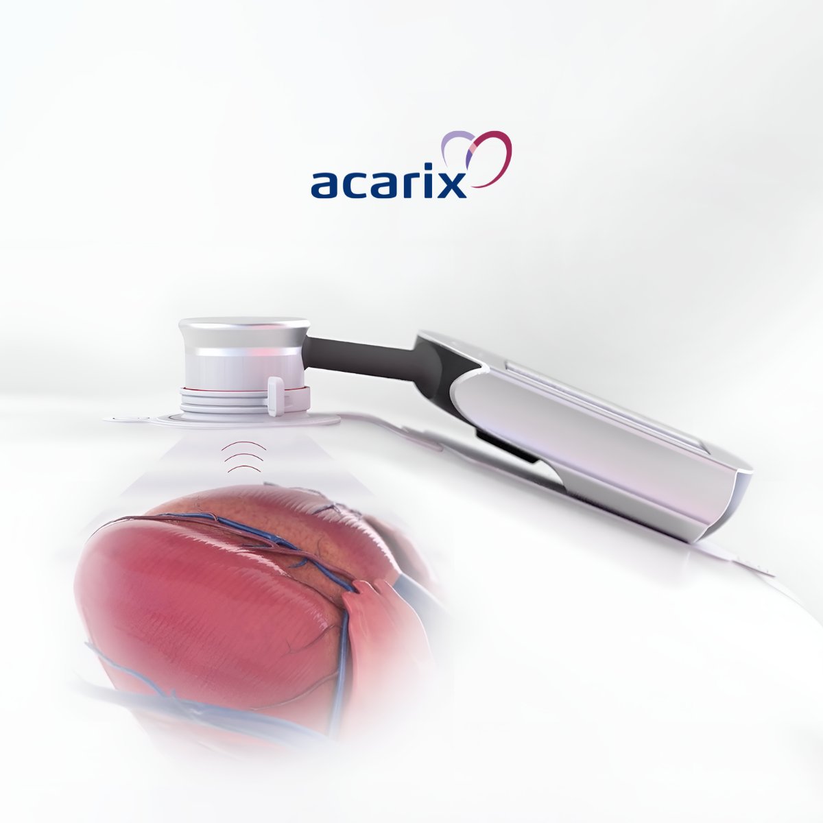 Acarix tweet media