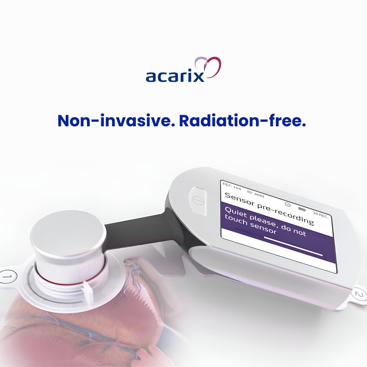 Acarix tweet media