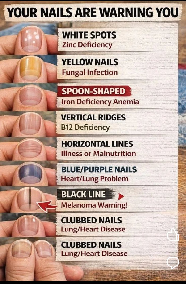 Nail signs can save your life !!