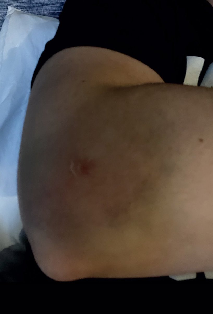 Jackie Barley tweet media