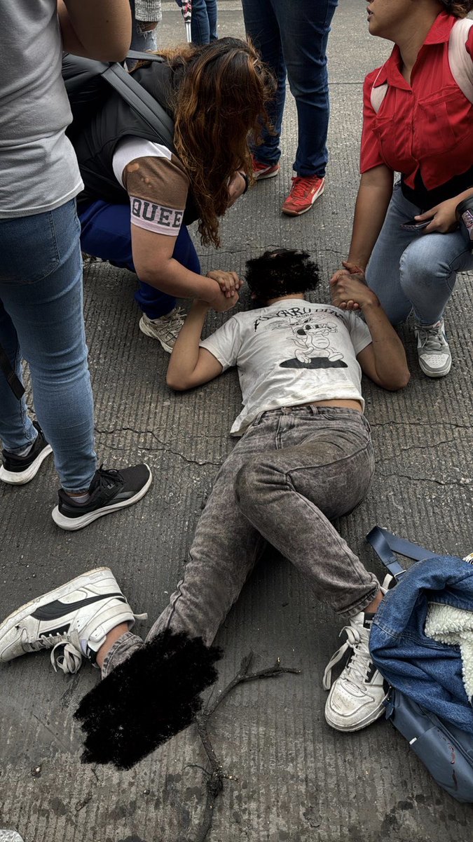 JerrxG13's tweet photo. Con MÚLTIPLES FRACTURAS joven fue TRASLADADO a Hospital tras ser ATROPELLADO…

*Calz Vallejo y Montevideo https://t.co/KYzsF0mMrX