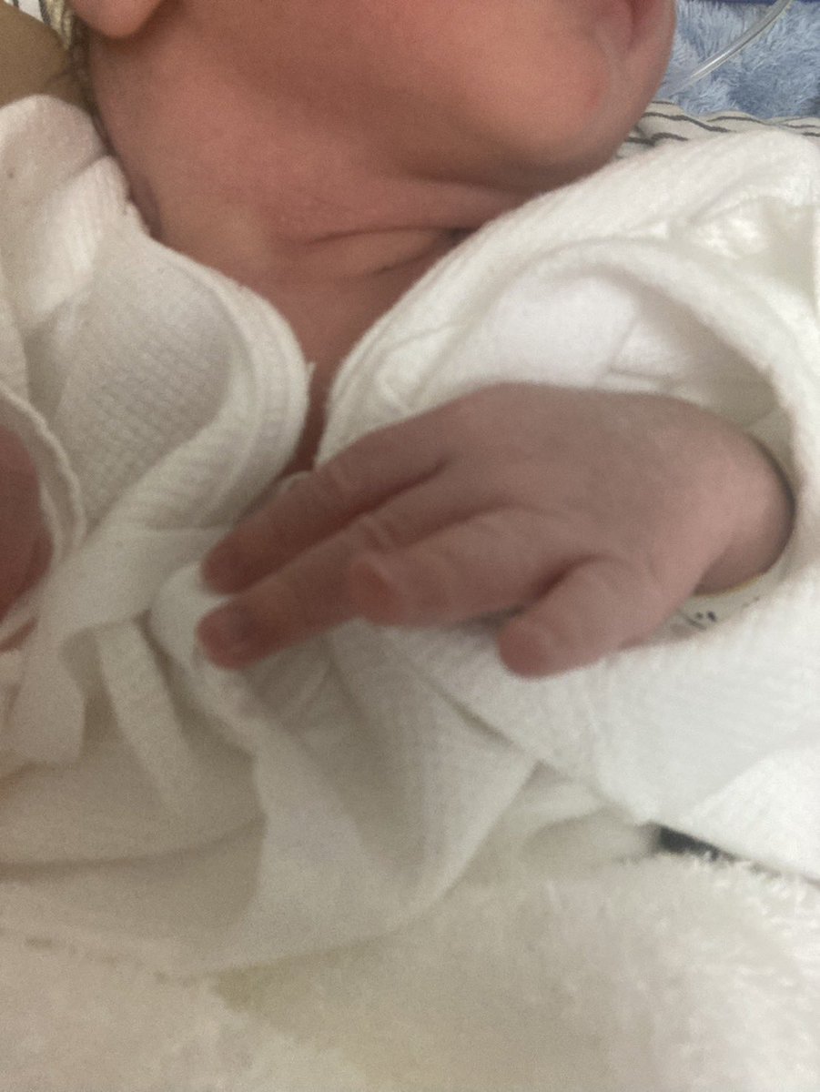 A9Hxi's tweet photo. 昨日の午前中に産まれました👶
母子ともに健康です。 https://t.co/6a9MsnaqM1