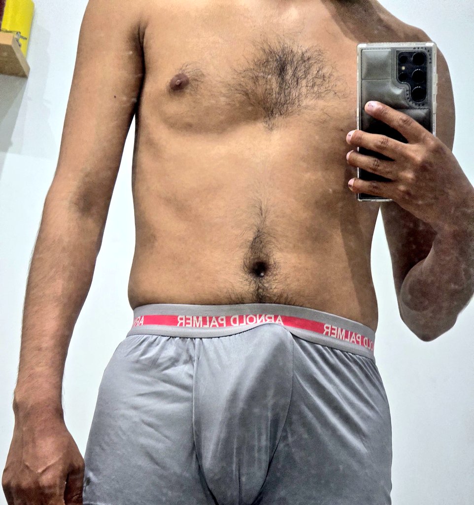 Andrew.ass tweet media