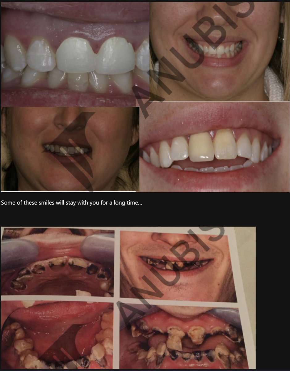 Anubis__media's tweet image. 🪥 New investigation: Ladue Family Dental

👄 A major leak of smiles.

🔦Full report (Tor Browser only): …4oqu4yodmqzl25mqd2hgllymrgu4aqd.onion/r/urjTEjedClIg…

#DataBreach #USA #Dental #MedicalData #RaaS
