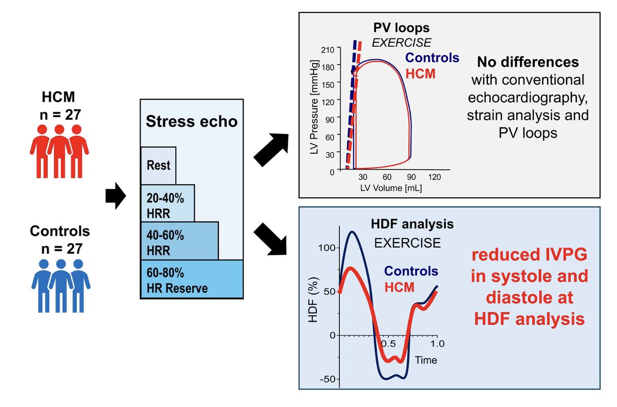 ESC_Journals's tweet image. Hemodynamic force (#HDF) analysis during exercise in hypertrophic cardiomyopathy (#HCM) reveals reduced longitudinal forces despite normal conventional systolic and diastolic indices, highlighting the potential of cardiac fluid dynamics imaging for early functional assessment.