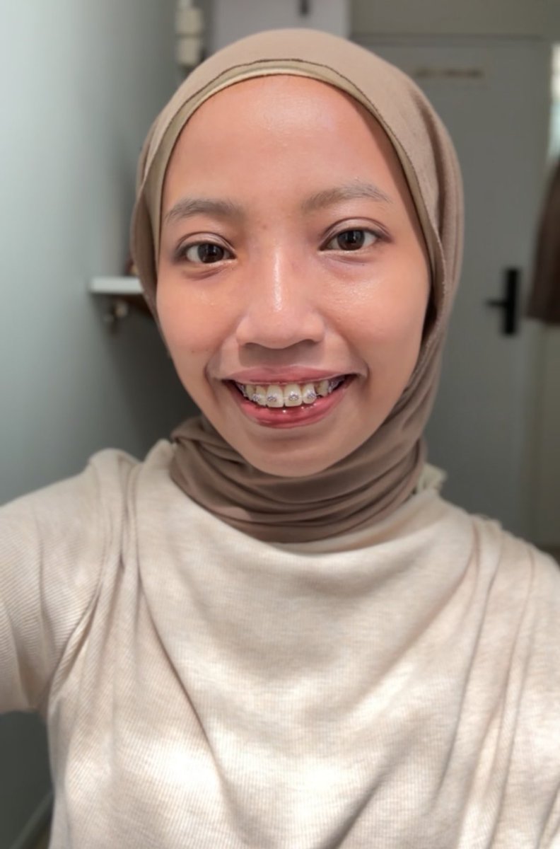 o89671's tweet image. Best brightening combo yang pelan-pelan balikin glow kulit kusamku &amp;lt;3
#SkincareTips