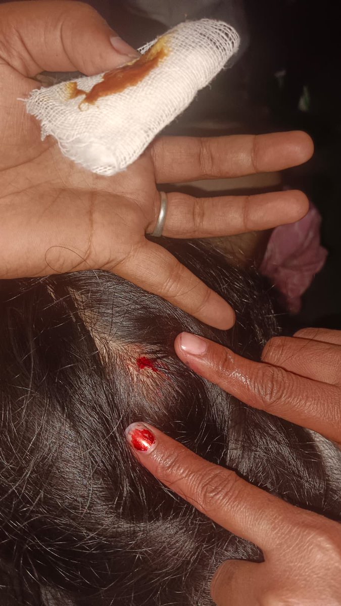 devkinandanpan's tweet photo. गाजियाबाद लोनी थाना के अंतर्गत महिला अधिवक्ता के साथ छेड़खानी मारपीट गाली धमकी लेकिन @ghazipurpolice ने अभी तक FIR तक नहीं लिखी उलटे पीड़ित को ही जेल भेजनें की धमकी दें रही है @ghaziabadpolice @dgpup @UMahilaayog @Uppolice @myogiadityanath @myogioffice @dm_ghaziabad https://t.co/AXFuCa1atb