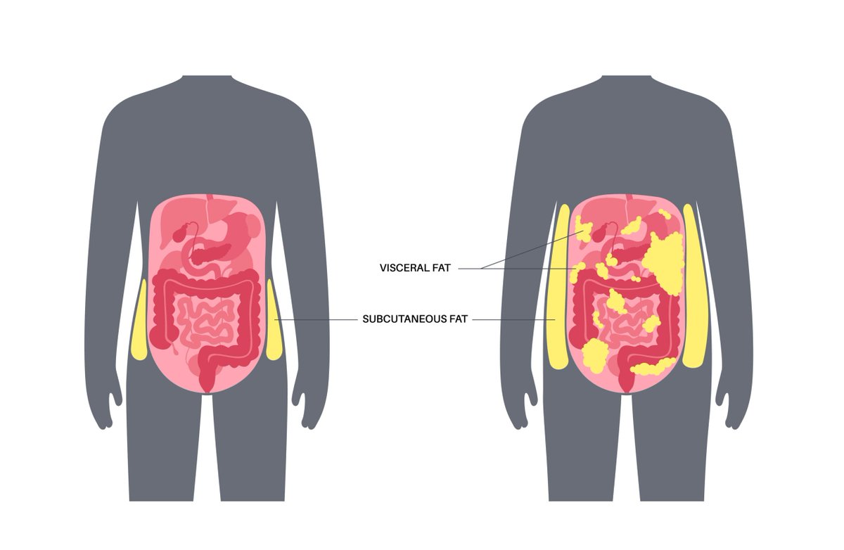 AasrawCo's tweet photo. How could GLP-1 agaonist receptor help to reduce visceral fat? https://t.co/Kx5uLPda2g