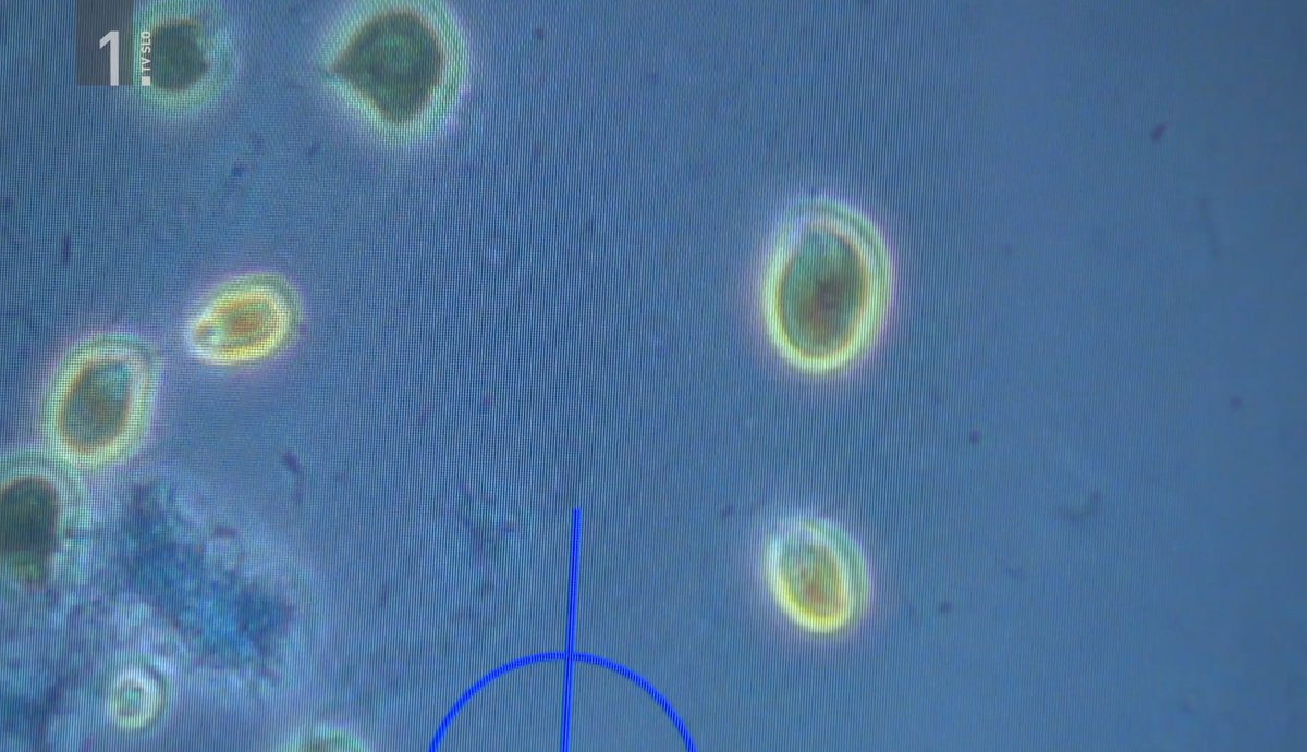 BBlue_Med's tweet photo. 🌊Slovenian Blue Biotech on TV 📺

#2BBLUE research in the Sečovlje Saltpans was featured on national 🇸🇮TV! Microalgae adapted to extreme salt &amp; sun may inspire new natural sunscreens &amp; skincare 🌿☀️ #BlueBiotech #Slovenia 

More: https://t.co/SafPrwvJEI https://t.co/AL8z5zcDoM