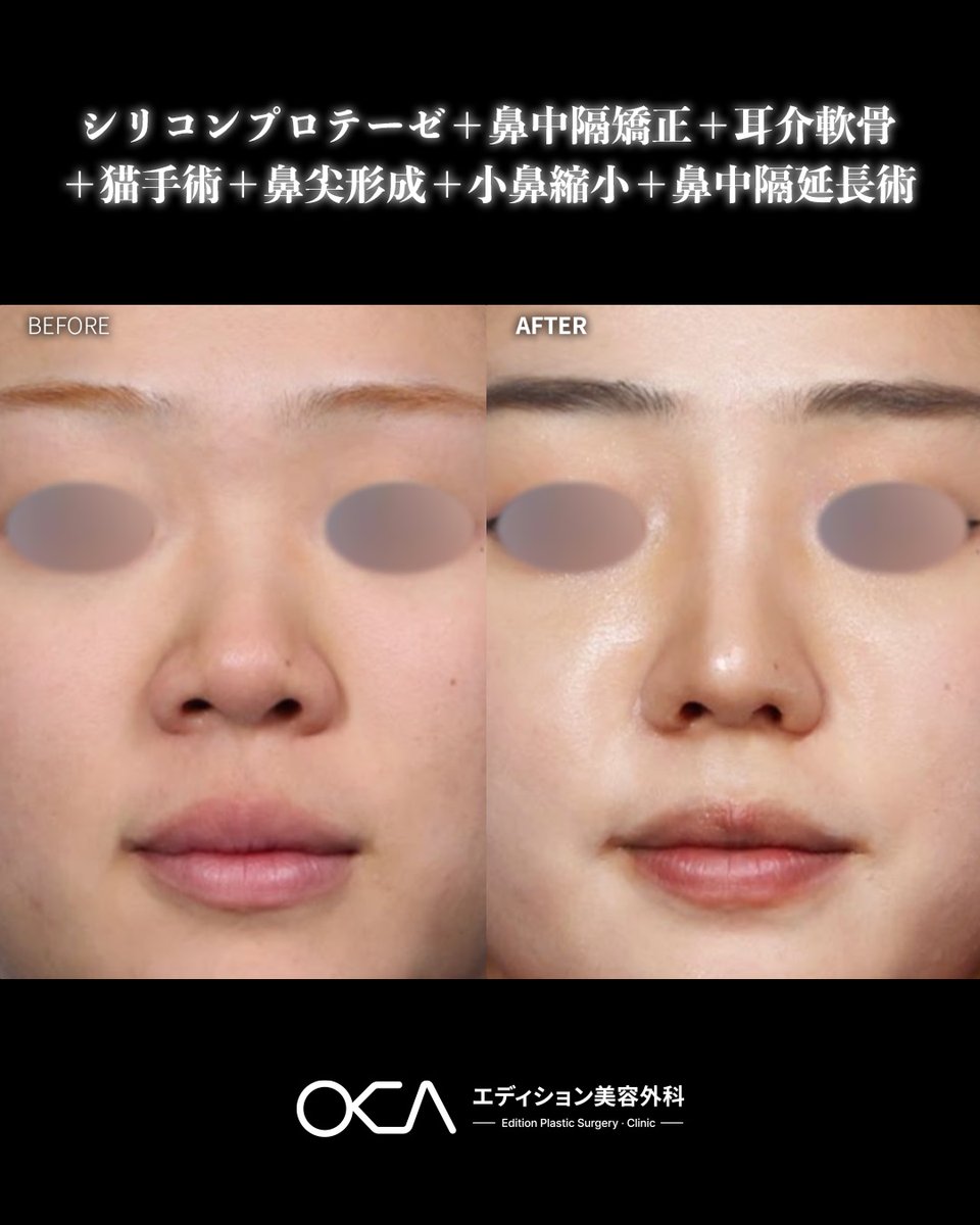 【公式】韓国エディション美容外科 tweet media