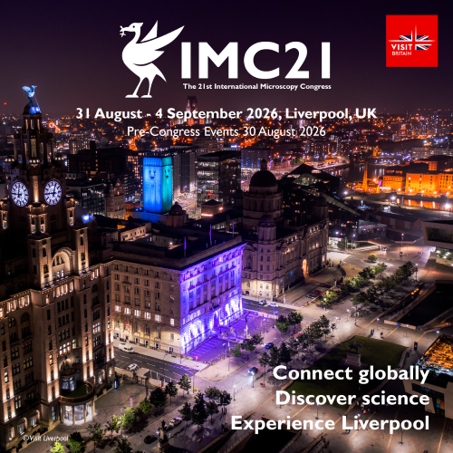 IMC21_Liverpool's tweet photo. 📣 Deadline *TODAY* (6 March):
Submit your abstract for the 21st International Microscopy Congress #IMC21

Don't miss the chance to share your work with the global #microscopy community in Liverpool this summer! 🔬😀

https://t.co/Hx0W5Mc2Tu https://t.co/ZrjT9Ddvcb