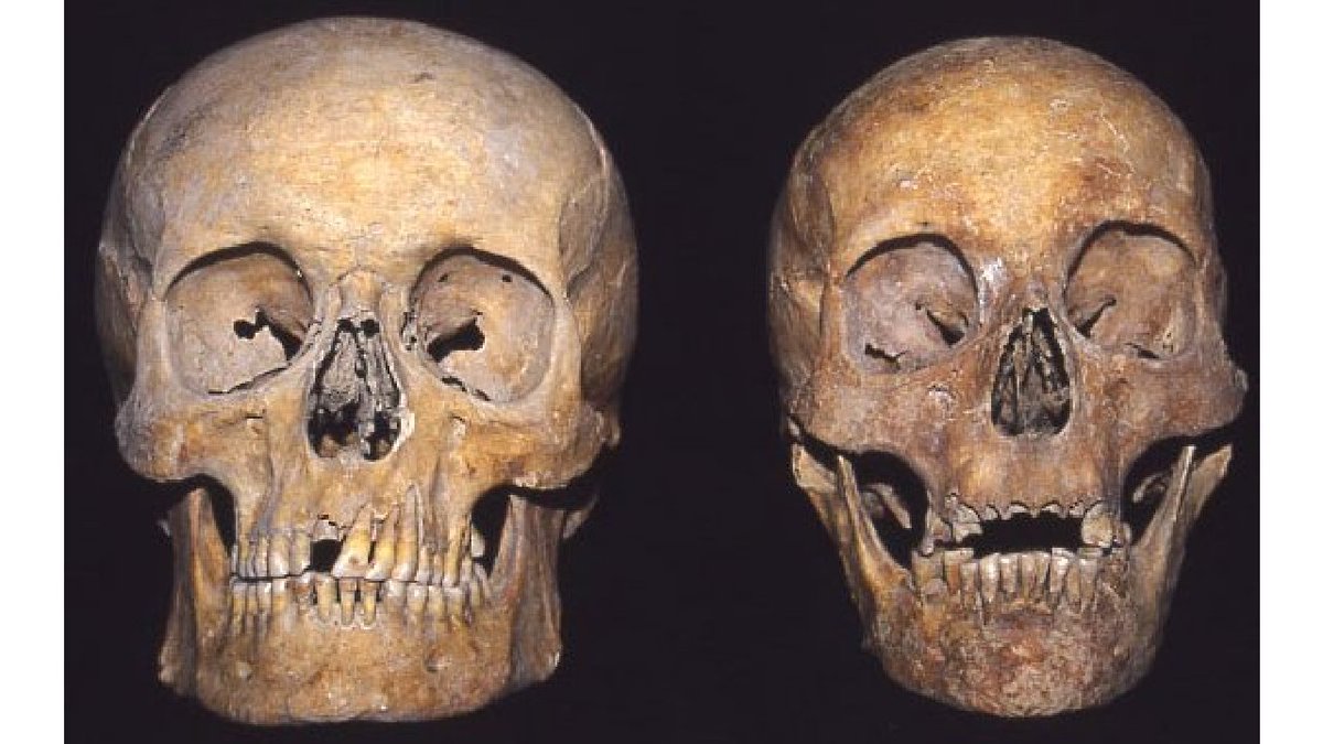 Shaun23042602's tweet photo. who--has what--skull---its a 50/50---and you get to pick https://t.co/8lg2gXPS3X