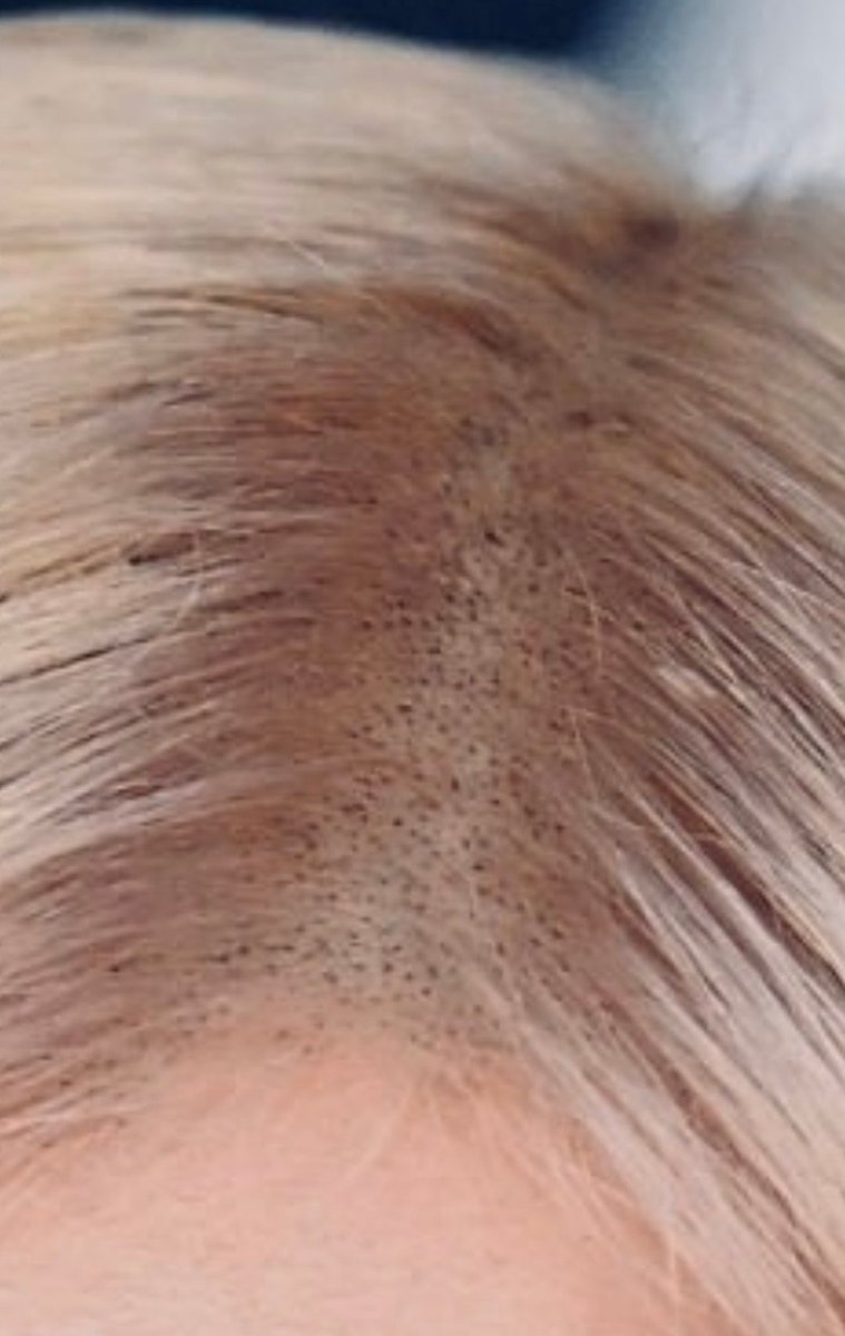 Justin054990231's tweet photo. 什么样的爹妈能教出来出道十年没捐款过小气鬼，诈捐拖欠工资的周扒皮，一辈子最恨自己生出黑发根不能内心自恰的可怜虫，一张专辑全是男人为了男人拌老奶奶毫无自尊的舔狗，染发剂入侵了她的大脑让她觉得自己是个白人，最后��得癌为结局 https://t.co/CTzVyIllBl