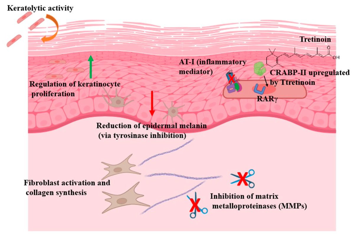 JCM_MDPI's tweet photo. #mdpijcm
#HighlyReviewed
#EditorChoice Paper
🙌An Updated Review of #TopicalTretinoin in #Dermatology: From Acne and Photoaging to #SkinCancer
🎯https://t.co/MhbzOcvKW8
👥@DrDidacBarco @ferrandiz_carla @DrSebastianDerm  🏬@UniBarcelona
@MediPharma_MDPI https://t.co/0OJXWMNo4r