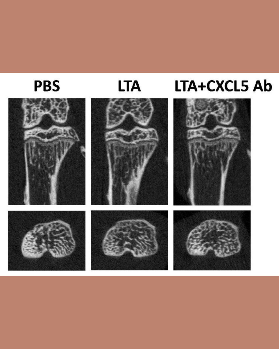 Bone & Joint Research tweet media