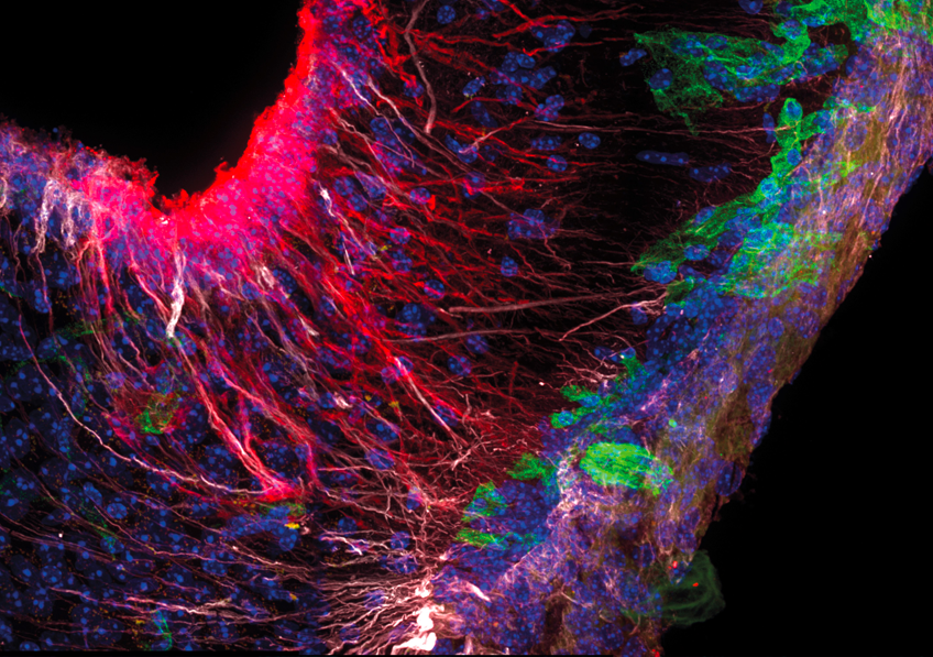 🧠 #Alzheimer : découverte de l’implication de nouvelles cellules dans l’apparition et la progression de la maladie

ow.ly/j7ck50YpQzt