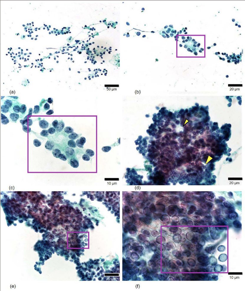 Cytojournal tweet media