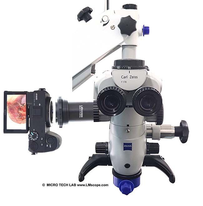 Micro_Tech_Lab's tweet photo. Microscopes et lampes à fente Zeiss OPMI : obtenez une qualité photo et vidéo exceptionnelle grâce aux hybrides modernes sans miroir! 
Plus d'informations: https://t.co/QuVmw18Yp7 https://t.co/DnBdpotTKy
