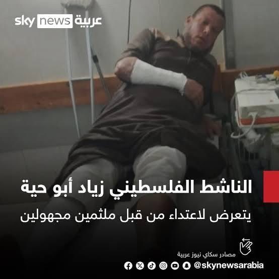 Unfortunately, you won’t find any human rights organizations, journalists, or media correspondents in Gaza speaking about what happened today to the young man in the first photo, Ashraf Nasr, nor demanding that Hamas stop arresting, torturing Palestinians, breaking their bones in